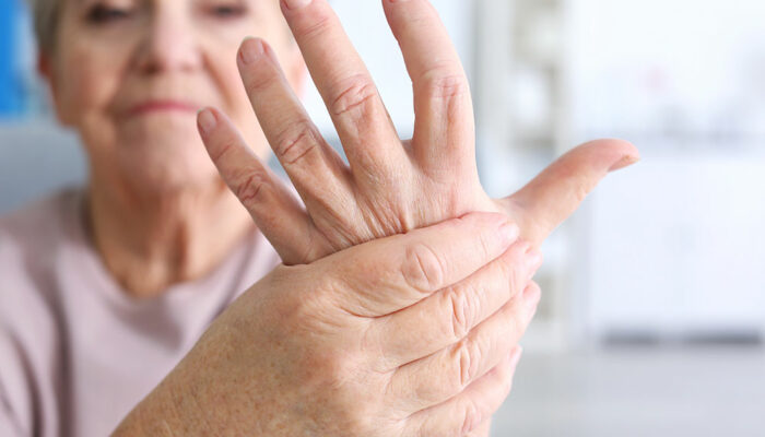 6 early arthritis signs one should not ignore